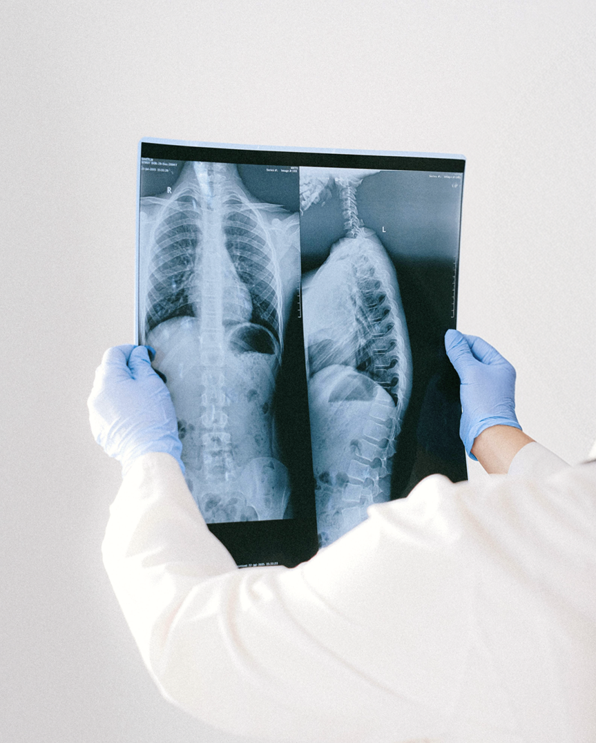 Full Body MRI Scan